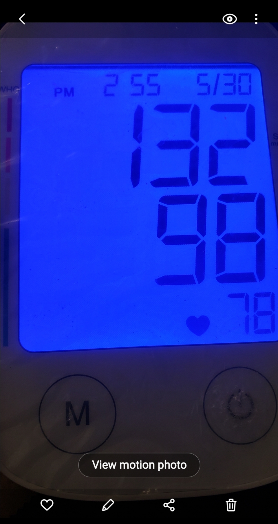 My results blood pressure